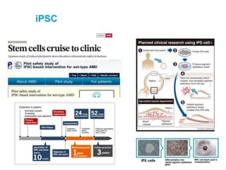 iPSC
32
 