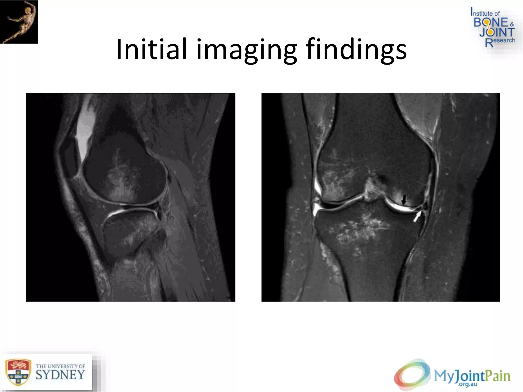 Initial imaging findings
 