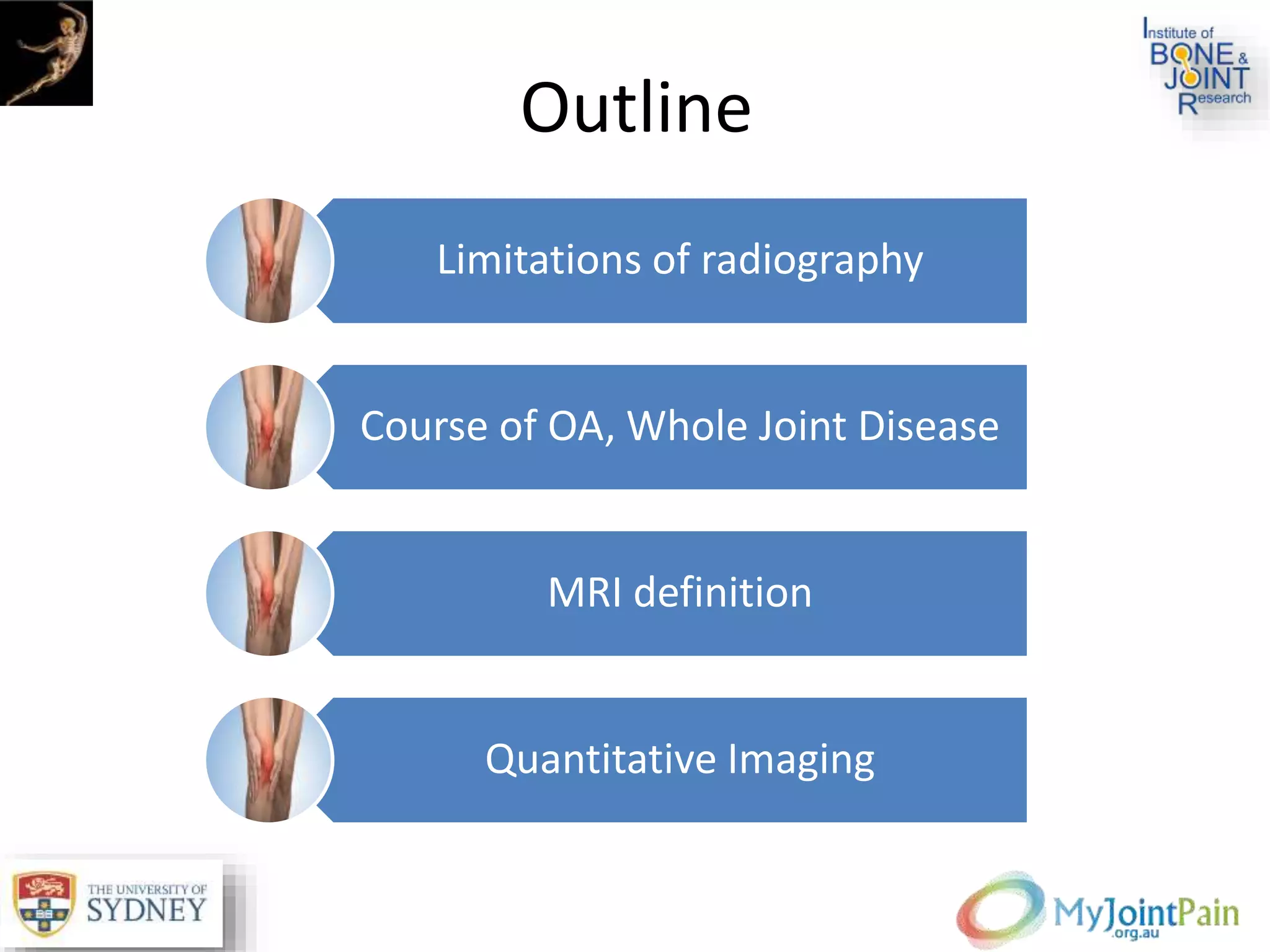 Outline
Limitations of radiography
Course of OA, Whole Joint Disease
MRI definition
Quantitative Imaging
 