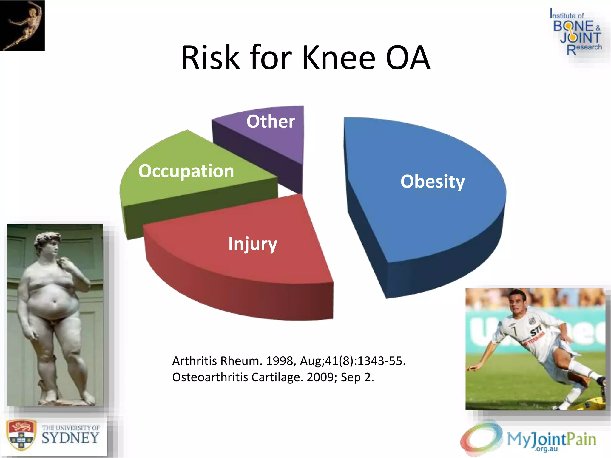 Risk for Knee OA
Obesity
Injury
Occupation
Other
Arthritis Rheum. 1998, Aug;41(8):1343-55.
Osteoarthritis Cartilage. 2009; Sep 2.
 