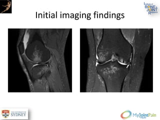 Initial imaging findings
 