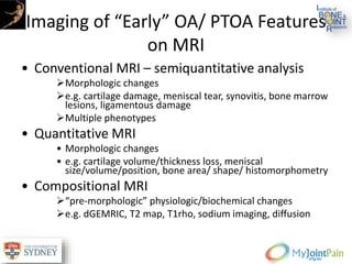 Imaging of “Early” OA/ PTOA Features
on MRI
• Conventional MRI – semiquantitative analysis
Morphologic changes
e.g. cartilage damage, meniscal tear, synovitis, bone marrow
lesions, ligamentous damage
Multiple phenotypes
• Quantitative MRI
• Morphologic changes
• e.g. cartilage volume/thickness loss, meniscal
size/volume/position, bone area/ shape/ histomorphometry
• Compositional MRI
“pre-morphologic” physiologic/biochemical changes
e.g. dGEMRIC, T2 map, T1rho, sodium imaging, diffusion
 