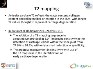T2 mapping
• Articular cartilage T2 reflects the water content, collagen
content and collagen fiber orientation in the ECM, with longer
T2 values thought to represent cartilage degeneration
• Kijowski et al. Radiology 2013;267:503-513.
 The addition of a T2 mapping sequence to
a routine MR protocol at 3.0 T improved sensitivity in the
detection of cartilage lesions within the knee joint from
74.6% to 88.9%, with only a small reduction in specificity.
 The greatest improvement in sensitivity with use of
the T2 maps was in the identification of
early cartilage degeneration.
 