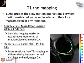 T1 rho mapping
• T1rho probes the slow motion interactions between
motion-restricted water molecules and their local
macromolecular environment.
• Regatte et al. J Magn Reson Imaging
2006; 23: 547-553
 Sensitive imaging marker for
quantitative monitoring of
macromolecules in early OA.
• Stahl et al. Eur Radiol 2009; 19: 132-
143.
 More sensitive than T2 mapping for
differentiating between normal
cartilage and early-stage OA.
 