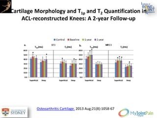 Cartilage Morphology and T1ρ and T2 Quantification in
ACL-reconstructed Knees: A 2-year Follow-up
Osteoarthritis Cartilage. 2013 Aug;21(8):1058-67
 