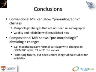 Conclusions
 Conventional MRI can show “pre-radiographic”
changes
 Morphologic changes that are not seen on radiography
 Validity and reliability well established now
 Compositional MRI shows “pre-morphologic”
physiologic changes
 e.g. morphologically normal cartilage with changes in
dGEMRIC index, T2 or T1rho values
 Promising future, but needs more longitudinal studies for
validation
 