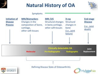 Natural History of OA
X-ray
Structural
changes in
bone
(i.e., joint
failure)
End-stage
Disease
(i.e., joint
death)
Initiation of
Disease
Process
MRI/Biomarkers
Changes in the
composition of bone,
cartilage,
other soft tissues
Symptoms
MRI /US
Structural changes
in bone,cartilage,
other soft tissues
Clinically detectable OA Joint
ReplacementRadiographicPre-Radiographic
Defining Disease State of Osteoarthritis
Molecular
 
