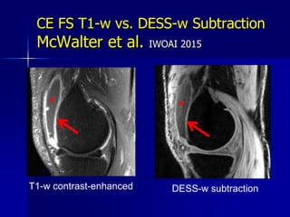 Imaging of Synovitis in OA | PPTX