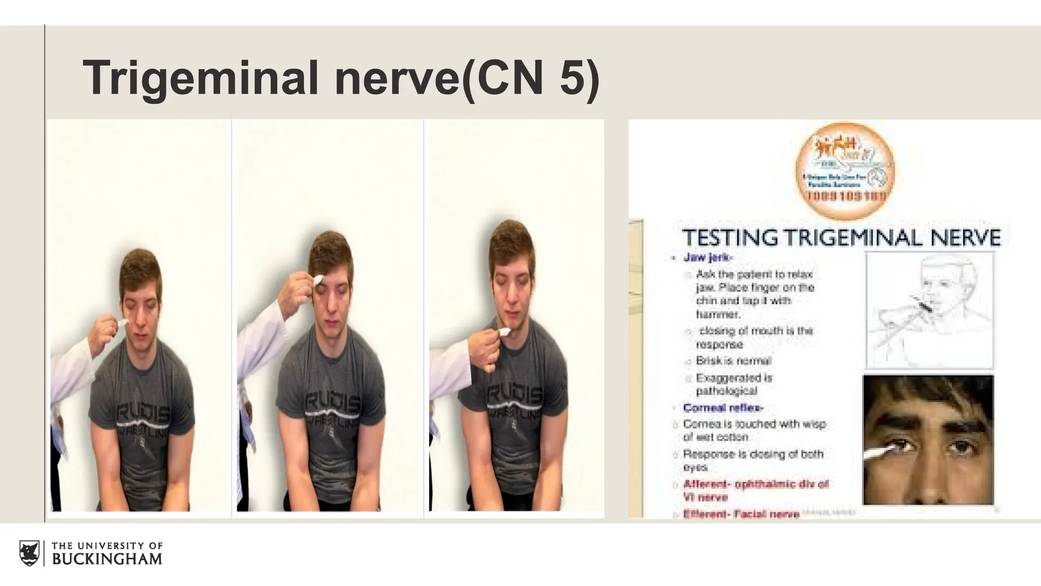 Trigeminal nerve(CN 5)
 
