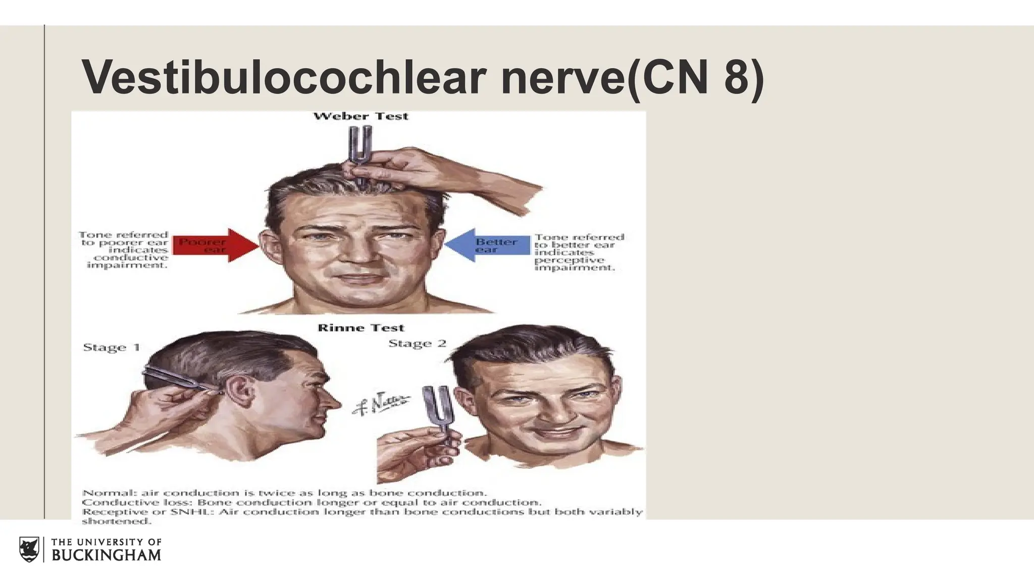 Vestibulocochlear nerve(CN 8)
 