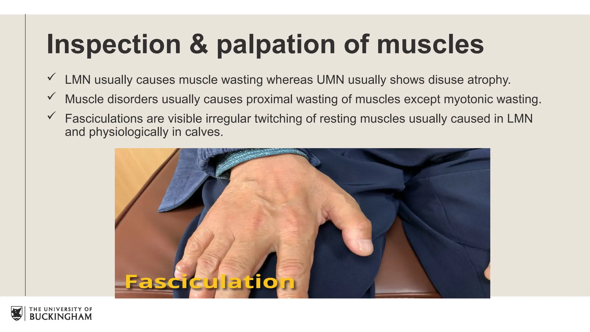 Inspection & palpation of muscles
 LMN usually causes muscle wasting whereas UMN usually shows disuse atrophy.
 Muscle disorders usually causes proximal wasting of muscles except myotonic wasting.
 Fasciculations are visible irregular twitching of resting muscles usually caused in LMN
and physiologically in calves.
 