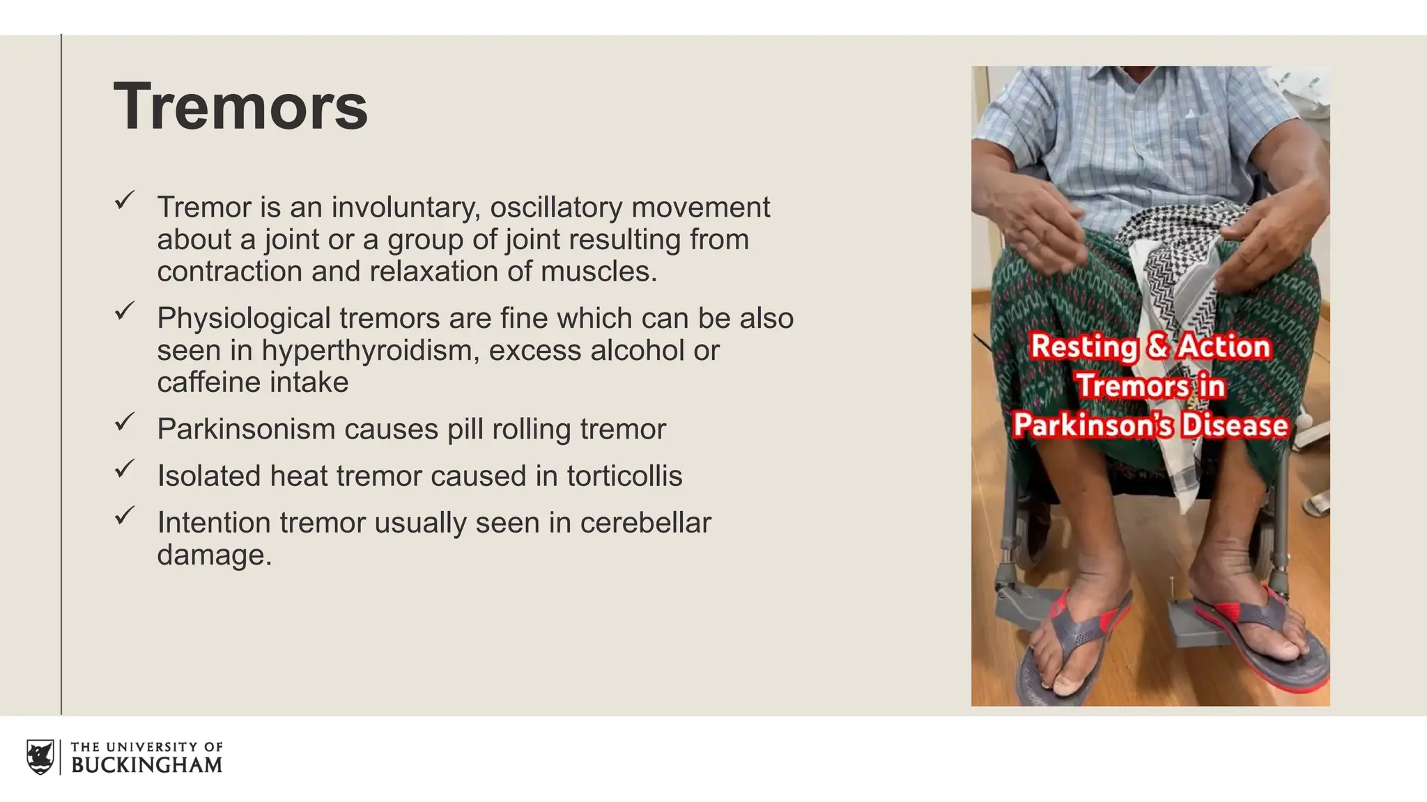 Tremors
 Tremor is an involuntary, oscillatory movement
about a joint or a group of joint resulting from
contraction and relaxation of muscles.
 Physiological tremors are fine which can be also
seen in hyperthyroidism, excess alcohol or
caffeine intake
 Parkinsonism causes pill rolling tremor
 Isolated heat tremor caused in torticollis
 Intention tremor usually seen in cerebellar
damage.
 