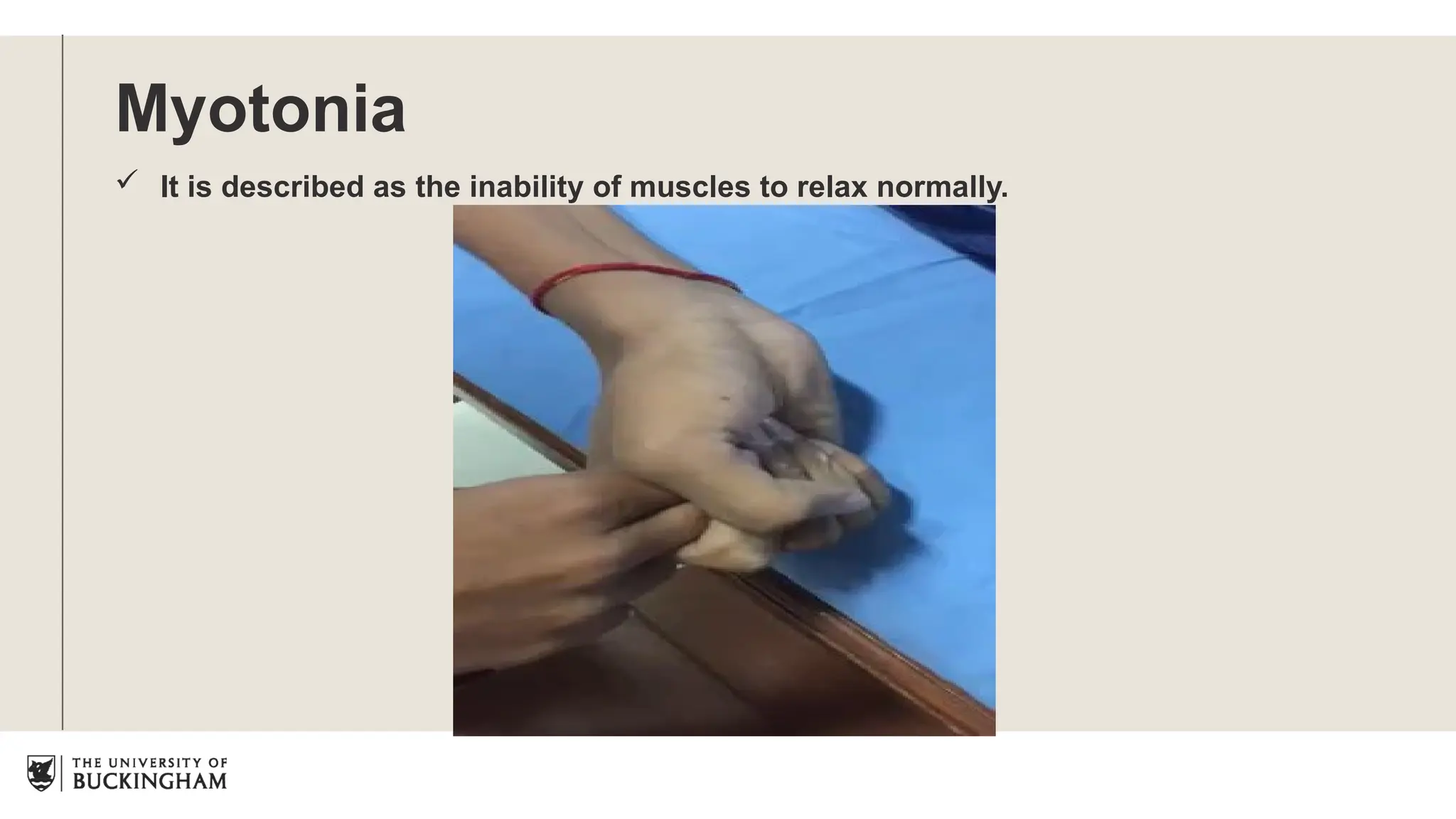 Myotonia
 It is described as the inability of muscles to relax normally.
 