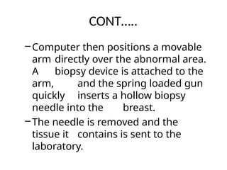 CONT…..
–Computer then positions a movable
arm directly over the abnormal area.
A biopsy device is attached to the
arm, and the spring loaded gun
quickly inserts a hollow biopsy
needle into the breast.
–The needle is removed and the
tissue it contains is sent to the
laboratory.
 