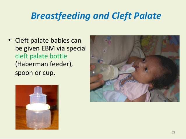 Session 10 Infants With Special Needs