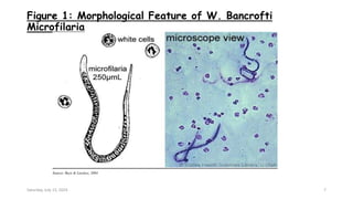 Figure 1: Morphological Feature of W. Bancrofti
Microfilaria
Source: Beye & Lawless, 2004
Saturday, July 13, 2024 7
 