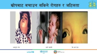 1/30/2023 4
Vff]kaf6 arfpg ;lsg] /f]ux? / hl6ntf
Eofu't] /f]u nx/] vf]sL l;=cf/=P;;
 