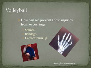 VolleyballHow can we prevent these injuries from occurring?Splints.Bandage.Correct warm up. www.physioroom.com