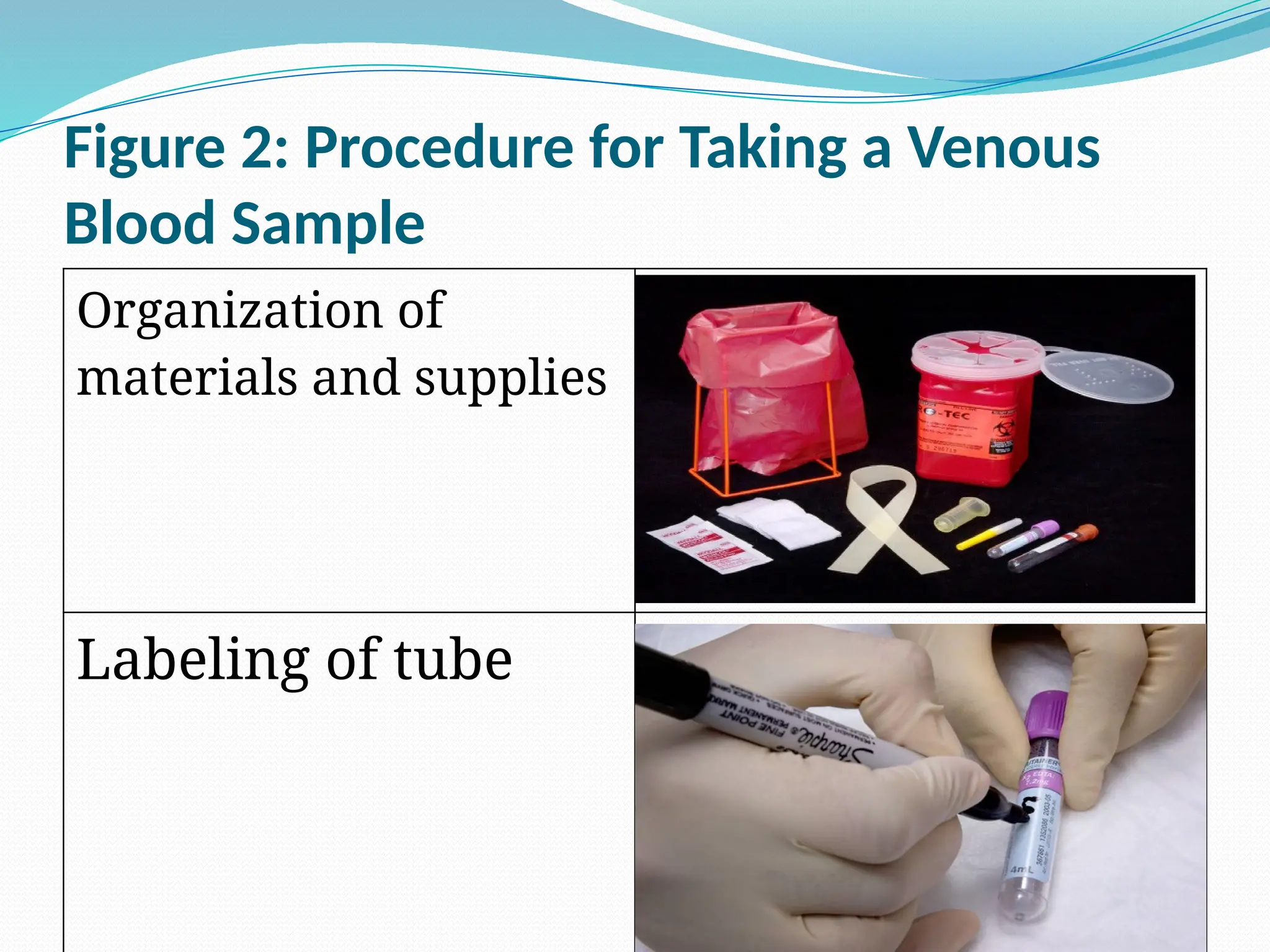 Figure 2: Procedure for Taking a Venous
Blood Sample
Organization of
materials and supplies
Labeling of tube
 