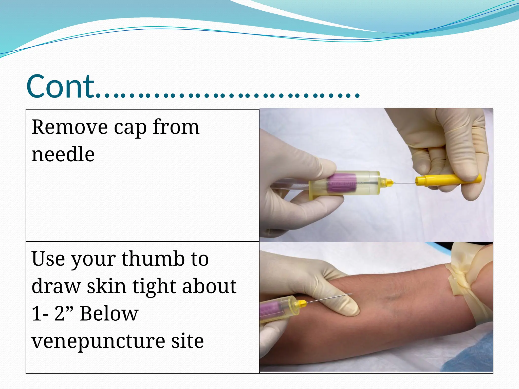 Cont…………………………..
Remove cap from
needle
Use your thumb to
draw skin tight about
1- 2” Below
venepuncture site
 