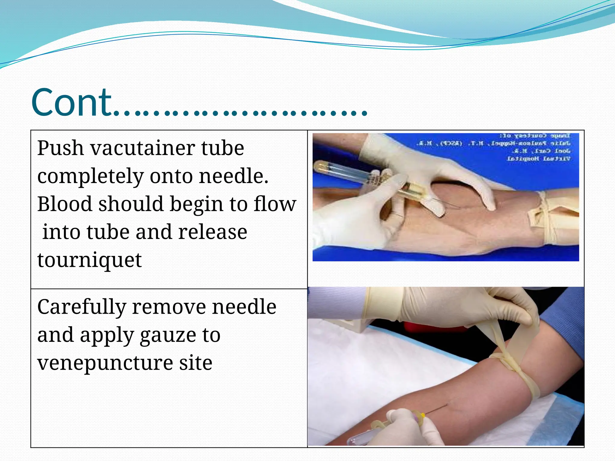 Cont……………………..
Push vacutainer tube
completely onto needle.
Blood should begin to flow
into tube and release
tourniquet
Carefully remove needle
and apply gauze to
venepuncture site
 