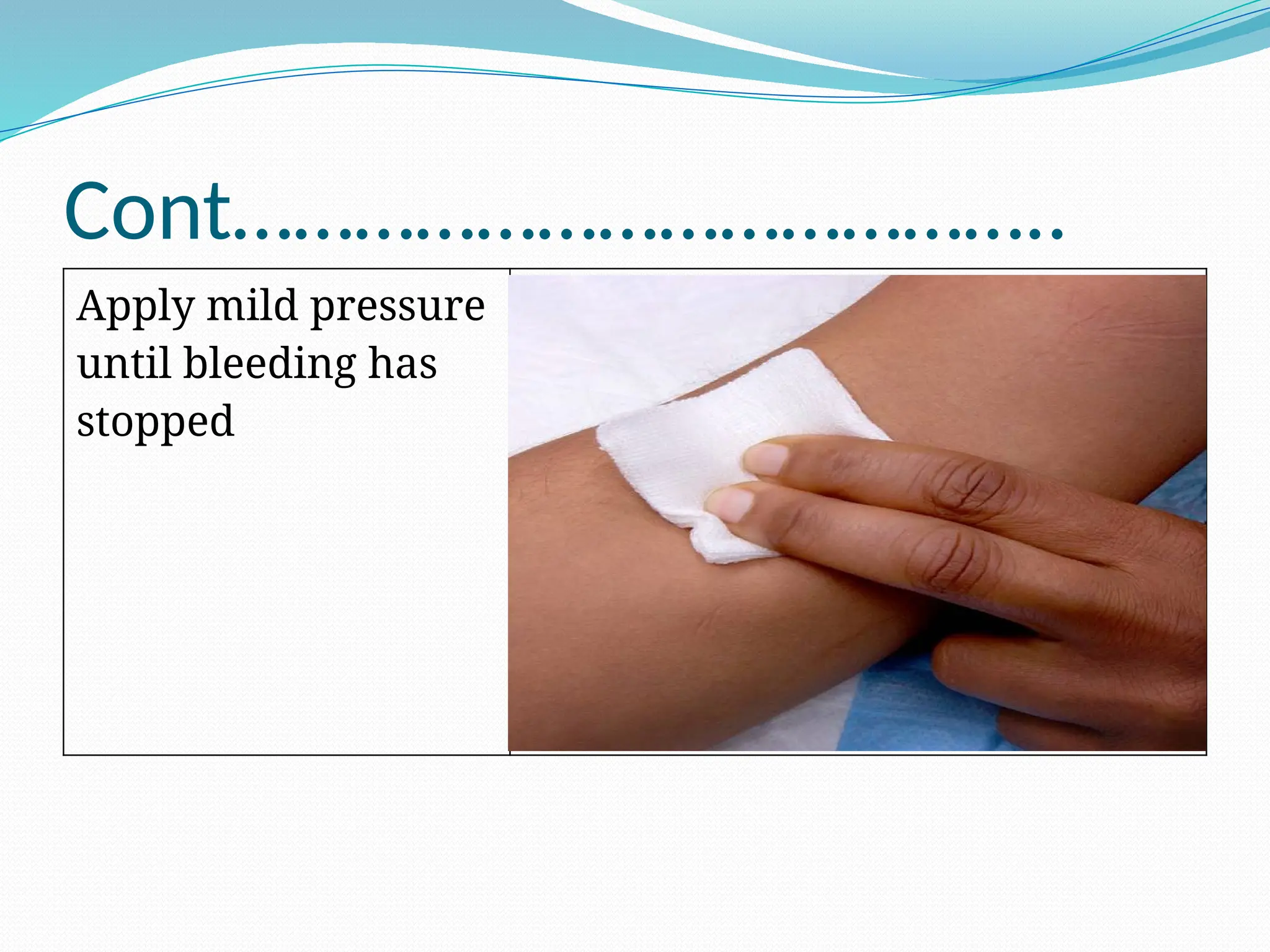 Cont…………………………………..
Apply mild pressure
until bleeding has
stopped
 