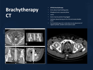 Vacloc Session 3 - Treatment Simulation in RT.pptx