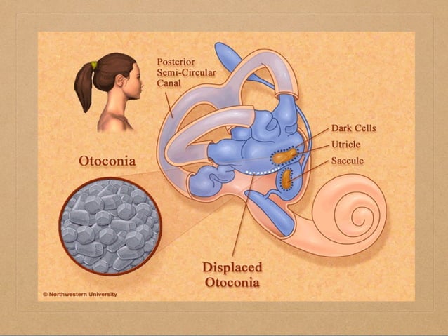 dizziness | PPT