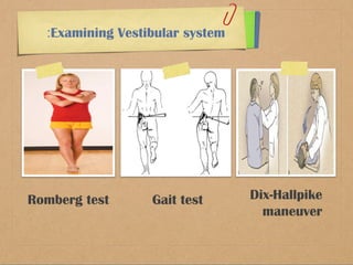 Romberg test Gait test Dix-Hallpike 
maneuver 
:Examining Vestibular system 
 