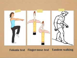 Fukuda test Finger-nose test Tandem walking 
 