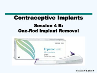 Session 4 B, Slide 1
Contraceptive Implants
Session 4 B:
One-Rod Implant Removal
 