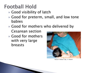  Good visibility of latch
 Good for preterm, small, and low tone
babies
 Good for mothers who delivered by
Cesarean section
 Good for mothers
with very large
breasts
Source: B. Wilson-Clay / K. Hoover
 