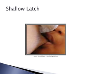 Source: United States Breastfeeding Coalition
 