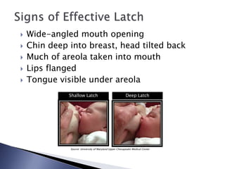  Wide-angled mouth opening
 Chin deep into breast, head tilted back
 Much of areola taken into mouth
 Lips flanged
 Tongue visible under areola
Source: University of Maryland Upper Chesapeake Medical Center
Shallow Latch Deep Latch
 