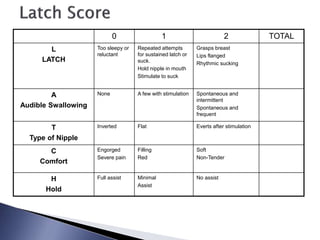 0 1 2 TOTAL
L
LATCH
Too sleepy or
reluctant
Repeated attempts
for sustained latch or
suck.
Hold nipple in mouth
Stimulate to suck
Grasps breast
Lips flanged
Rhythmic sucking
A
Audible Swallowing
None A few with stimulation Spontaneous and
intermittent
Spontaneous and
frequent
T
Type of Nipple
Inverted Flat Everts after stimulation
C
Comfort
Engorged
Severe pain
Filling
Red
Soft
Non-Tender
H
Hold
Full assist Minimal
Assist
No assist
 