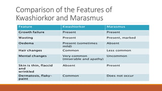 Comparison of the Features of
Kwashiorkor and Marasmus
 