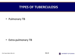 TYPES OF TUBERCULOSIS
• Pulmonary TB
• Extra-pulmonary TB
Prof. Kwasi Addo, SON, UG Slide 20
 