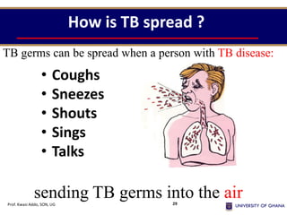 How is TB spread ?
• Coughs
• Sneezes
• Shouts
• Sings
• Talks
TB germs can be spread when a person with TB disease:
sending TB germs into the air
Prof. Kwasi Addo, SON, UG 29
 