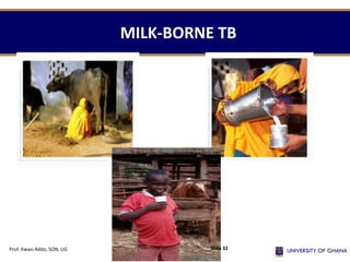MILK-BORNE TB
Prof. Kwasi Addo, SON, UG Slide 32
 
