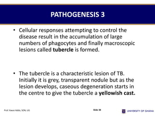 PATHOGENESIS 3
• Cellular responses attempting to control the
disease result in the accumulation of large
numbers of phagocytes and finally macroscopic
lesions called tubercle is formed.
• The tubercle is a characteristic lesion of TB.
Initially it is grey, transparent nodule but as the
lesion develops, caseous degeneration starts in
the centre to give the tubercle a yellowish cast.
Prof. Kwasi Addo, SON, UG Slide 38
 