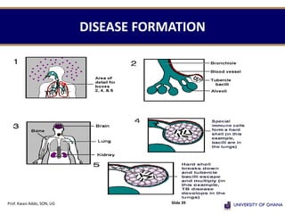 DISEASE FORMATION
Prof. Kwasi Addo, SON, UG Slide 39
 