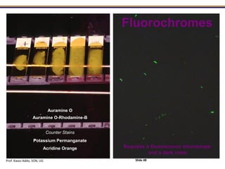 Fluorochromes
Auramine O
Auramine O-Rhodamine-B
Counter Stains
Potassium Permanganate
Acridine Orange Requires a fluorescence microscope
and a dark room
Prof. Kwasi Addo, SON, UG Slide 48
 