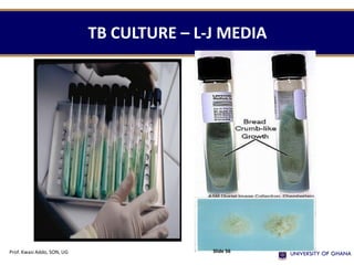 TB CULTURE – L-J MEDIA
Prof. Kwasi Addo, SON, UG Slide 56
 