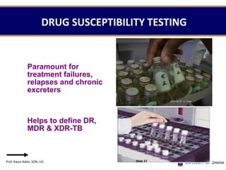 DRUG SUSCEPTIBILITY TESTING
Paramount for
treatment failures,
relapses and chronic
excreters
Helps to define DR,
MDR & XDR-TB
Prof. Kwasi Addo, SON, UG Slide 57
 