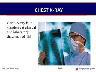CHEST X-RAY
Chest X-ray is to
supplement clinical
and laboratory
diagnosis of TB
Prof. Kwasi Addo, SON, UG Slide 63
 