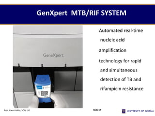 GenXpert MTB/RIF SYSTEM
Automated real-time
nucleic acid
amplification
technology for rapid
and simultaneous
detection of TB and
rifampicin resistance
Prof. Kwasi Addo, SON, UG Slide 67
 