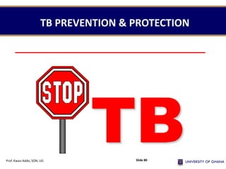 TB PREVENTION & PROTECTION
TB
Prof. Kwasi Addo, SON, UG Slide 80
 