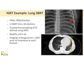 Roundel Ctv Examples Session 8 - IGRT_ Guidelines for Matching _ Alignment, Methods ...