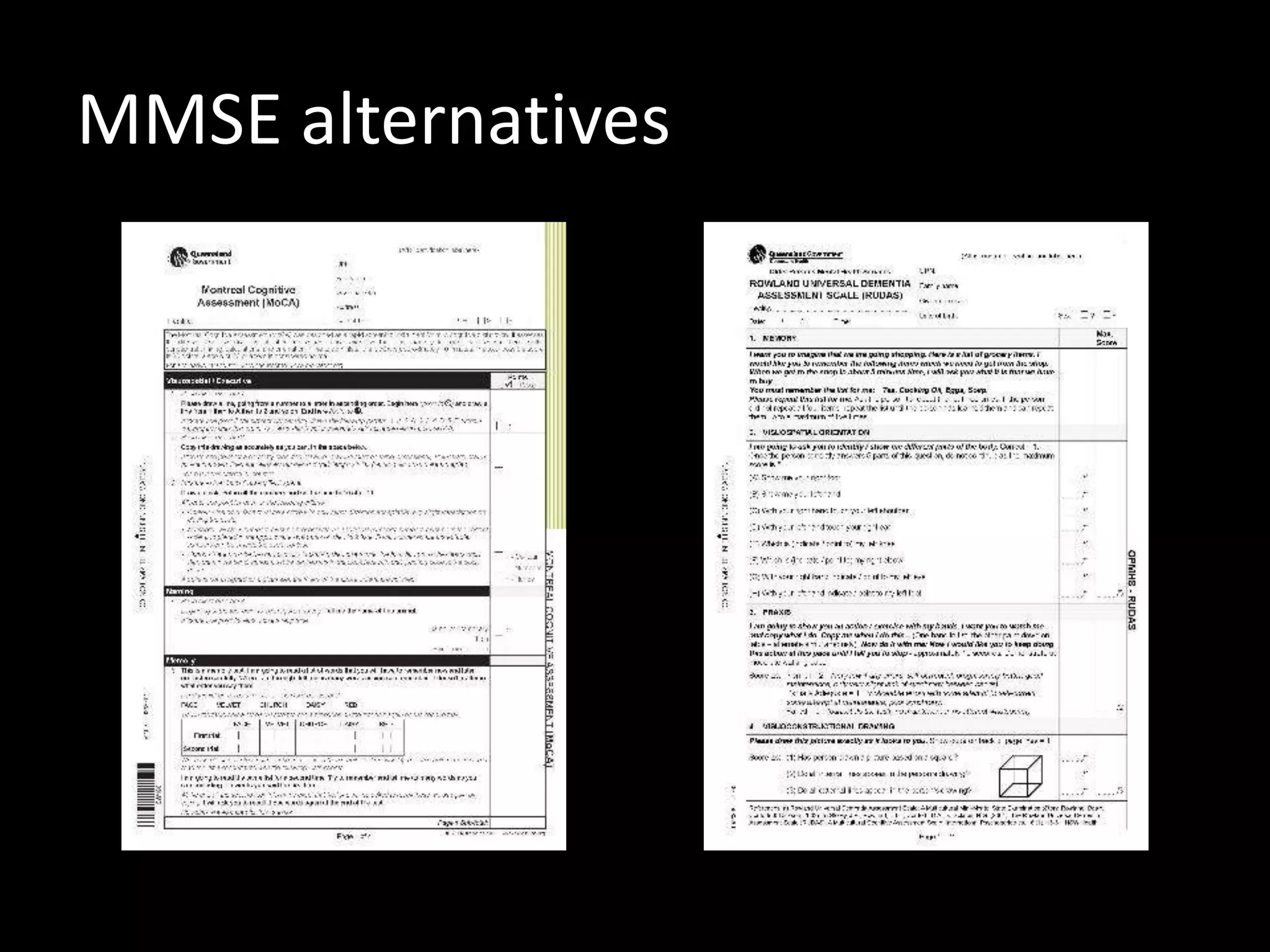 MMSE alternatives
 