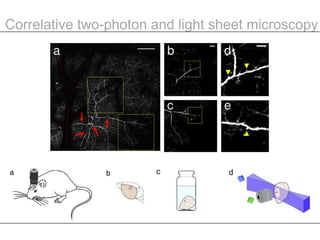 Whole brain optical imaging | PPTX